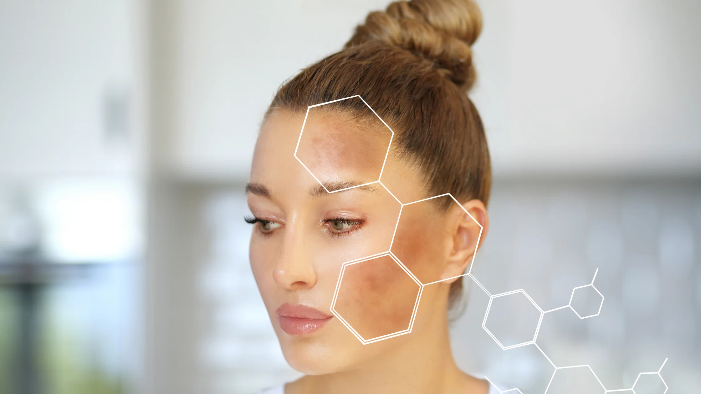 Melanin Break Treatment